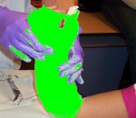 Pols in t gips